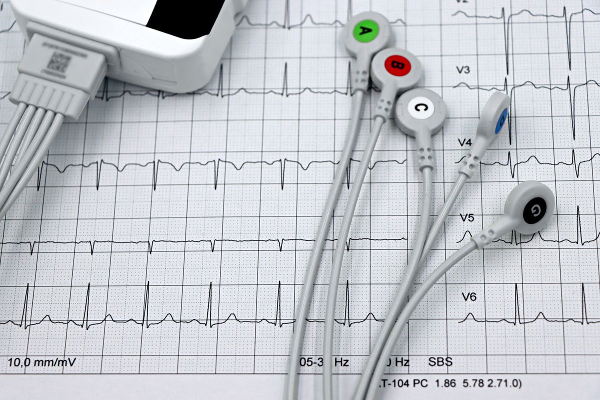 Fréquence cardiaque cible : comment la calculer - Comprendre la fréquence cardiaque cible et son intérêt