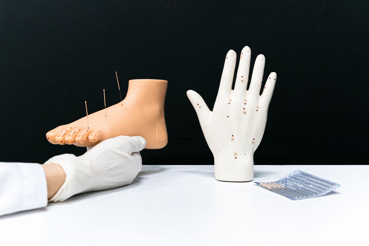 Points d’acupuncture du pied : la carte complète